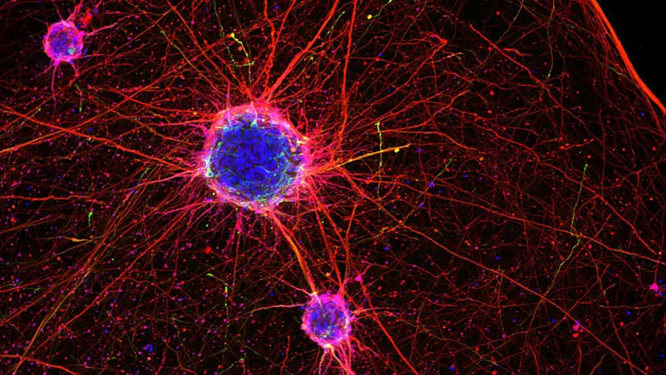 Nerve cells. photo